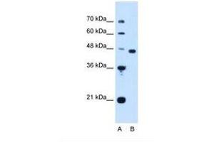 Image no. 1 for anti-Proliferation-Associated 2G4, 38kDa (PA2G4) (AA 178-227) antibody (ABIN321304) (PA2G4 抗体  (AA 178-227))