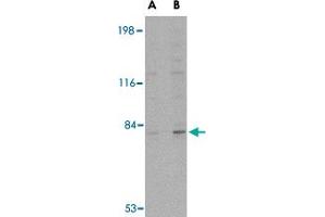 Western blot analysis of GPAM in rat brain tissue lysate with GPAM polyclonal antibody  at (A) 1 and (B) 2 ug/mL . (GPAM 抗体)