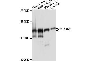 Western blot analysis of extracts of various cell lines, using CLASP2 antibody. (CLASP2 抗体)