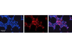 Rabbit Anti-CDC42 Antibody  AV Formalin Fixed Paraffin Embedded Tissue: Human Bone Marrow Tissue Observed Staining: Cytoplasm, Plasma membrane Primary Antibody Concentration: 1:100 Other Working Concentrations: 1:600 Secondary Antibody: Donkey anti-Rabbit-Cy3 Secondary Antibody Concentration: 1:200 Magnification: 20X Exposure Time: 0. (CDC42 抗体  (N-Term))