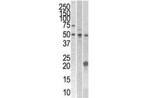 STYK1 antibody western blot analysis with 293, CEM, and mouse kidney cell line/tissue lysate (STYK1 抗体  (AA 31-64))