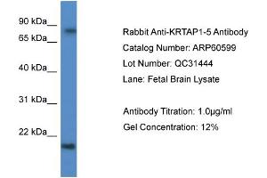 Western Blotting (WB) image for anti-Keratin Associated Protein 1-5 (KRTAP1-5) (C-Term) antibody (ABIN2788509) (KRTAP1-5 抗体  (C-Term))