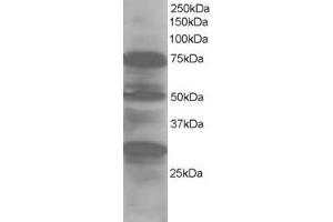 Western Blotting (WB) image for anti-LIM Domain 7 (LMO7) (Internal Region) antibody (ABIN2465906)