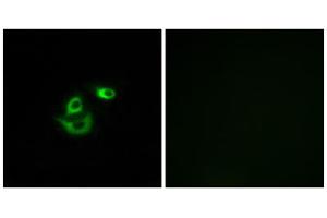 Immunofluorescence analysis of A549 cells, using CLCC1 antibody. (CLCC1 抗体  (Internal Region))