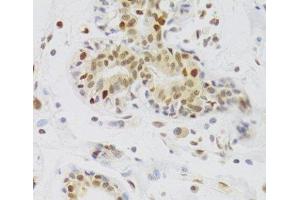 Immunohistochemistry of paraffin-embedded Human breast using NASP Polyclonal Antibody at dilution of 1:100 (40x lens). (NASP 抗体)