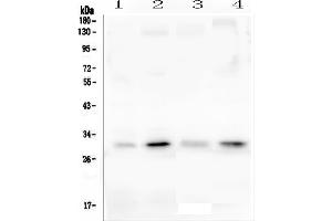Western blot analysis of PEF1 using anti-PEF1 antibody (ABIN6719632). (PEF1 抗体  (AA 170-284))