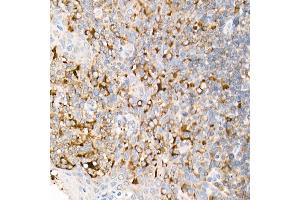 Immunohistochemistry of paraffin-embedded Human tonsil using FasLG antibody (ABIN3020741, ABIN3020742, ABIN3020743, ABIN1512897 and ABIN6213701) at dilution of 1:150 (40x lens).