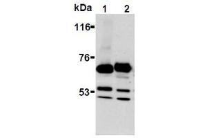 Western Blotting (WB) image for anti-Synaptotagmin I (SYT1) antibody (ABIN1109184) (SYT1 抗体)