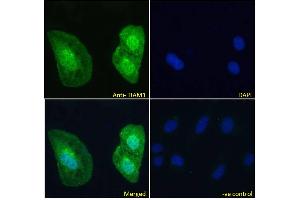 ABIN6391387 Immunofluorescence analysis of paraformaldehyde fixed U2OS cells, permeabilized with 0. (TIAM1 抗体  (C-Term))