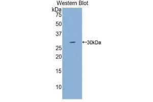 Western Blotting (WB) image for anti-Interleukin 2 Receptor, gamma (IL2RG) (AA 23-262) antibody (ABIN1174734) (IL2RG 抗体  (AA 23-262))