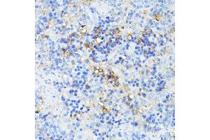 Immunohistochemistry of paraffin-embedded rat spleen using TP53I11 antibody (ABIN6131365, ABIN6149418, ABIN6149419 and ABIN6216636) at dilution of 1:100 (40x lens). (TP53I11 抗体  (AA 1-70))