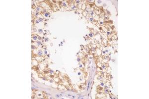 (ABIN6242519 and ABIN6577251) staining PDXK in human testis tissue sections by Immunohistochemistry (IHC-P - paraformaldehyde-fixed, paraffin-embedded sections). (PDXK 抗体  (AA 1-312))