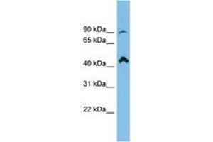 Image no. 1 for anti-NEDD4 Binding Protein 2-Like 2 (N4BP2L2) (AA 107-156) antibody (ABIN6745094) (N4BP2L2 抗体  (AA 107-156))