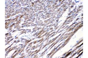 IHC testing of FFPE rat heart tissue with CHRNA5 antibody at 1ug/ml.