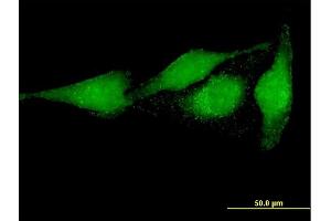 Immunofluorescence of purified MaxPab antibody to PRUNE on HeLa cell. (PRUNE 抗体  (AA 1-453))