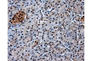 Immunohistochemical staining of paraffin-embedded Kidney tissue using anti-GBE1 mouse monoclonal antibody. (GBE1 抗体)