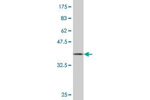 Western Blot detection against Immunogen (37. (SH3GL1 抗体  (AA 12-119))