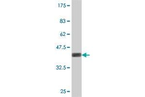 Western Blot detection against Immunogen (37 KDa) . (Stabilin 1 抗体  (AA 1804-1902))