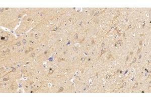 Immunohistochemistry (IHC) image for anti-Sema Domain, Seven Thrombospondin Repeats (Type 1 and Type 1-Like), Transmembrane Domain (TM) and Short Cytoplasmic Domain, (Semaphorin) 5B (SEMA5B) (AA 350-602) antibody (ABIN7426943)