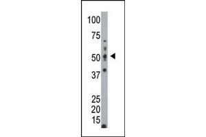 Image no. 1 for anti-Glucokinase (Hexokinase 4) (GCK) (C-Term) antibody (ABIN360274)