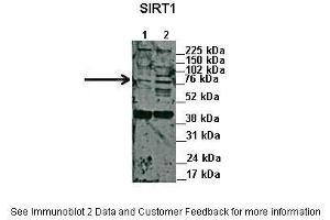 Lanes:   1. (SIRT1 抗体  (N-Term))