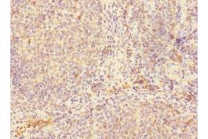 Immunohistochemistry of paraffin-embedded human tonsil tissue using ABIN7147132 at dilution of 1:100 (Integrin beta 2 抗体  (AA 24-220))