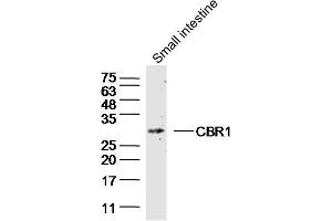 Mouse small intestine lysate (40ug) probed with CBR1 Polyclonal Antibody, unconjugated  at 1:300 overnight at 4°C followed by a conjugated secondary antibody for 60 minutes at 37°C. (CBR1 抗体  (AA 201-277))