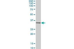 DKK1 monoclonal antibody (M02), clone 1F5. (DKK1 抗体  (AA 81-180))