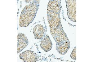 IHC analysis of PDCD6IP using anti-PDCD6IP antibody (ABIN7600490). (ALIX 抗体  (AA 2-330))