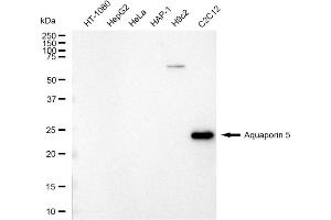 Western blotting analysis using Aquaporin 5 antibody (ABIN7797638).