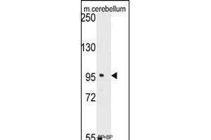 Western blot analysis of anti-SEA Antibody (C-term) (ABIN389214 and ABIN2839370) pre-incubated with(right lane) and without(left lane) blocking peptide in mouse cerebellum tissue lysate.