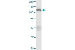 Immunoprecipitation of PKN1 transfected lysate using anti-PKN1 MaxPab rabbit polyclonal antibody and Protein A Magnetic Bead , and immunoblotted with PKN1 purified MaxPab mouse polyclonal antibody (B01P) . (PKN1 抗体  (AA 1-942))