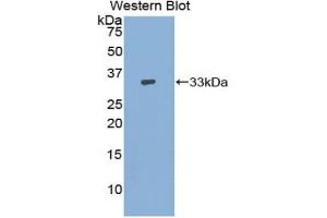 Western blot analysis of the recombinant protein. (ADCY9 抗体  (AA 1029-1282))