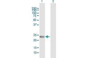 Western Blot analysis of FNDC4 expression in transfected 293T cell line by FNDC4 MaxPab polyclonal antibody. (FNDC4 抗体  (AA 1-234))