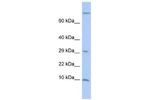Western Blotting (WB) image for anti-Matrix Gla Protein (MGP) antibody (ABIN2459483) (MGP 抗体)