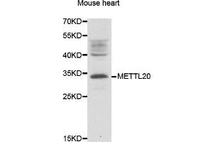 Western blot analysis of extracts of Mouse heart lysate, using METTL20 antibody. (METTL20 抗体)