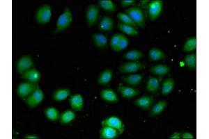 Immunofluorescent analysis of A549 cells using ABIN7145071 at dilution of 1:100 and Alexa Fluor 488-congugated AffiniPure Goat Anti-Rabbit IgG(H+L) (COQ8B 抗体  (AA 10-137))