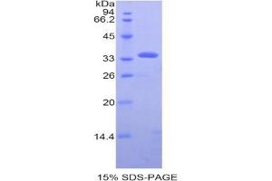 SDS-PAGE analysis of Human PDHb Protein. (PDHB 蛋白)