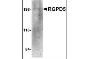 Western blot analysis of RGPD5 in human thymus tissue lysate with this product at 1 μg/ml. (RGPD5 / RGPD6 (N-Term) 抗体)