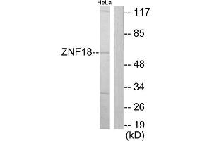 Western blot analysis of extracts from HeLa cells, using ZNF18 antibody. (ZNF18 抗体  (Internal Region))