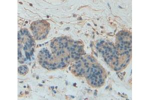 Immunohistochemistry (IHC) image for anti-Signal Transducer and Activator of Transcription 5A (STAT5A) (AA 673-773) antibody (ABIN1174962)
