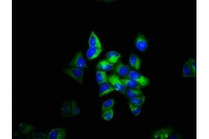 Immunofluorescence staining of Hela cells with ABIN7171484 at 1:133, counter-stained with DAPI. (TLN1 抗体  (AA 92-399))