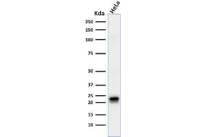 Western Blot of HeLa, cell lysate using Ferritin, Heavy Chain Mouse Monoclonal Antibody (FTH/2081). (FTH1 抗体  (AA 58-180))