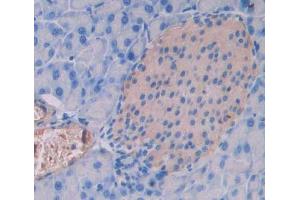 Immunohistochemistry (IHC) image for anti-Protein tyrosine Phosphatase, Receptor Type, N Polypeptide 2 (PTPRN2) (AA 782-1001) antibody (ABIN5014205)