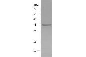 Western Blotting (WB) image for POU Class 5 Homeobox 1 (POU5F1) (AA 233-360) protein (His-IF2DI Tag) (ABIN7124537)