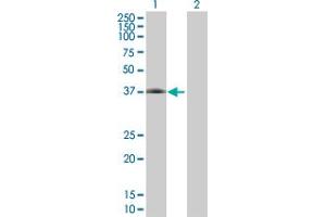 Western Blot analysis of CFHR1 expression in transfected 293T cell line by CFHR1 MaxPab polyclonal antibody. (CFHR1 抗体  (AA 1-330))