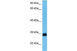 Host:  Mouse  Target Name:  PDX1  Sample Tissue:  Mouse Testis  Antibody Dilution:  1ug/ml (PDX1 抗体  (N-Term))