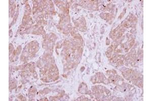 Image no. 1 for anti-Protein Phosphatase, EF-Hand Calcium Binding Domain 1 (PPEF1) (AA 361-650) antibody (ABIN1500360) (PPEF1 抗体  (AA 361-650))