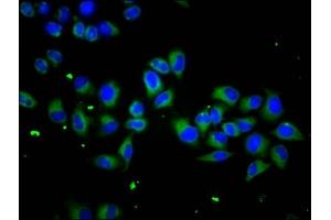 Immunofluorescence staining of Hela cells with ABIN7169635 at 1:133, counter-stained with DAPI. (SCUBE1 抗体  (AA 453-566))