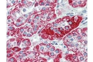 Immunohistochemistry (IHC) image for anti-Transient Receptor Potential Cation Channel, Subfamily C, Member 6 (TRPC6) (C-Term) antibody (ABIN964697)